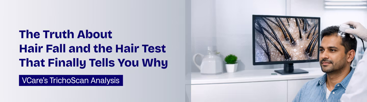 TrichoScan hair analysis test for hair fall
