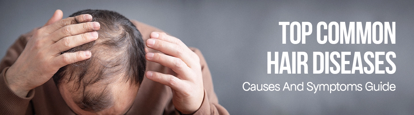 common hair diseases symptoms
 

