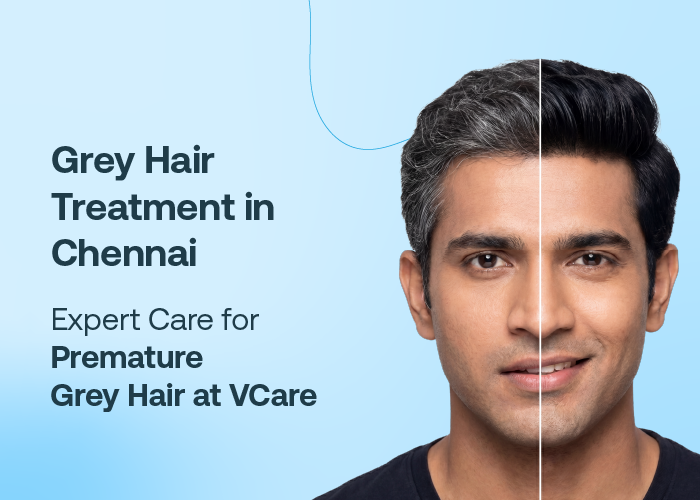 Black Hair Kit for premature grey hair 

