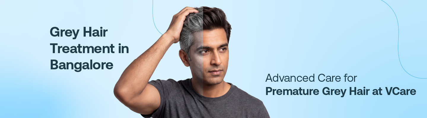 Grey hair treatment in Bangalore

 


