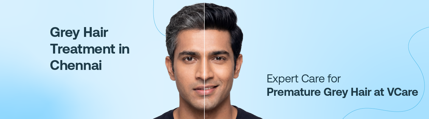 Grey hair treatment in Chennai at VCare



