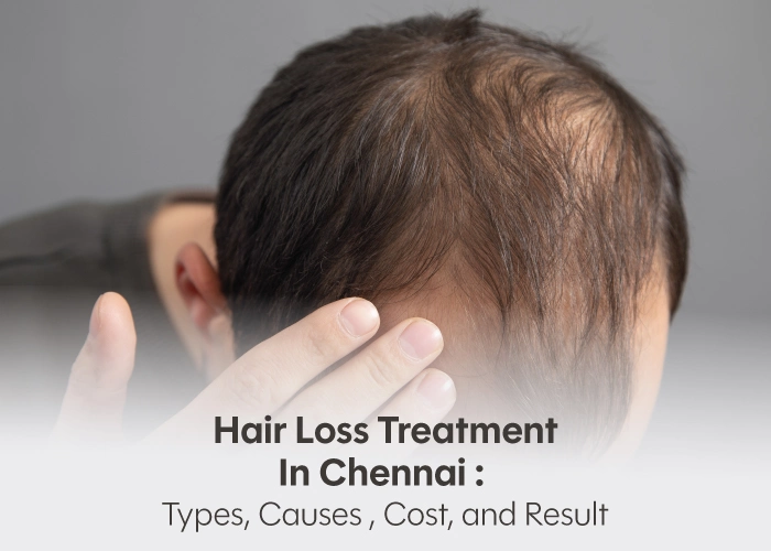 hair loss treatment cost in chennai

