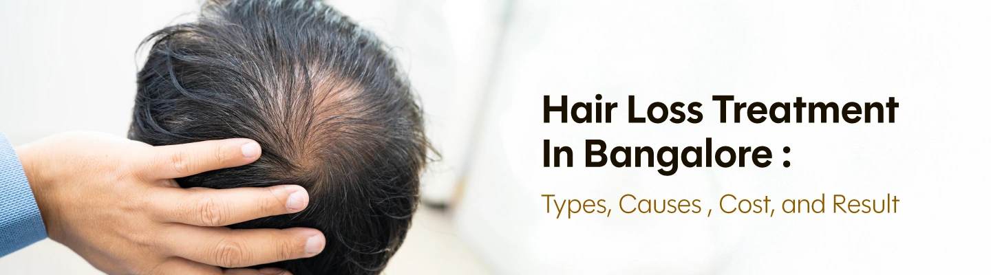 hair loss treatment in bangalore​ 

 

