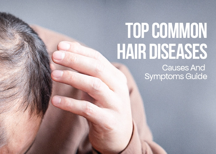 types of scalp diseases and hair loss
