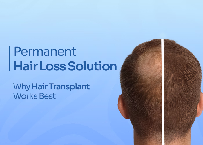 hair loss treatment