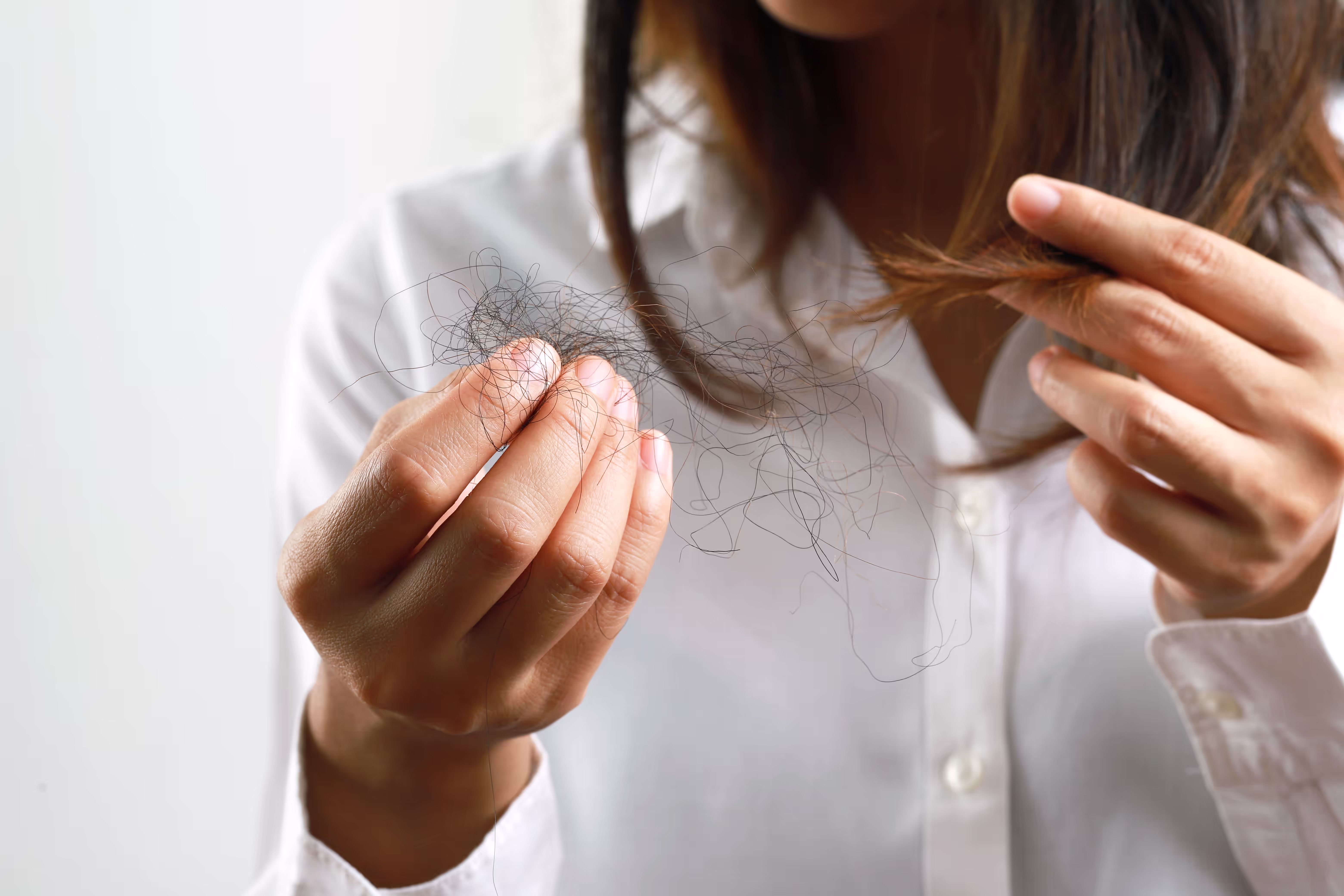 Hair loss in women