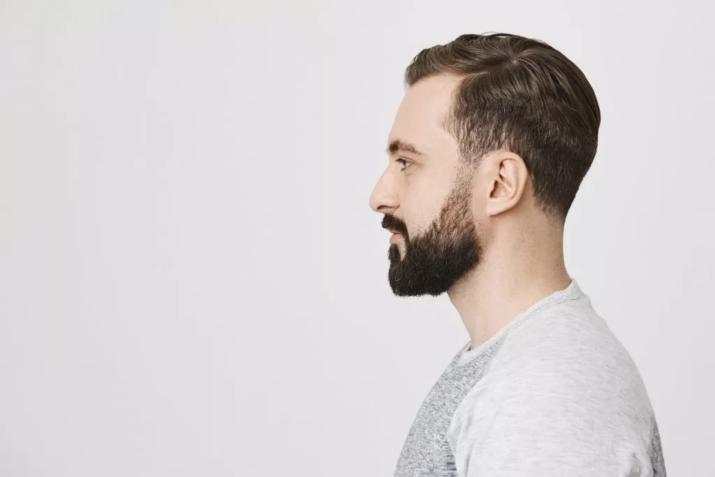 Beard Transplantation with VCare Beard Transplantation with VCare