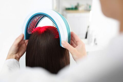 IS HAIR LOSS STRESSING YOU OUT?
Top Benefits Of Undergoing Stem Cell Therapy For Hair At VCare