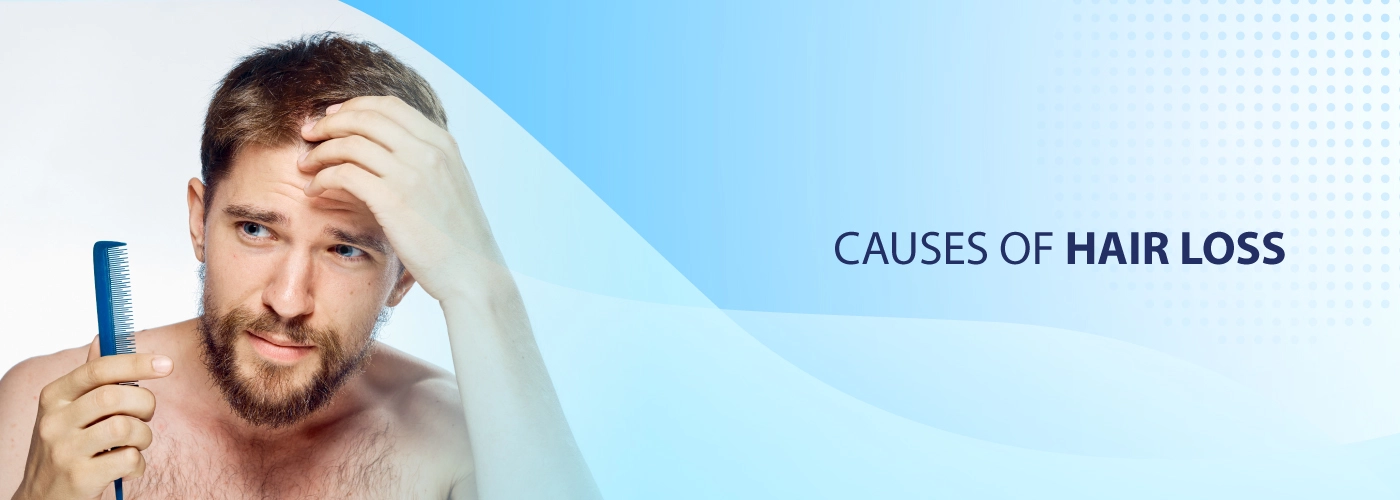 causes-of-hair-loss