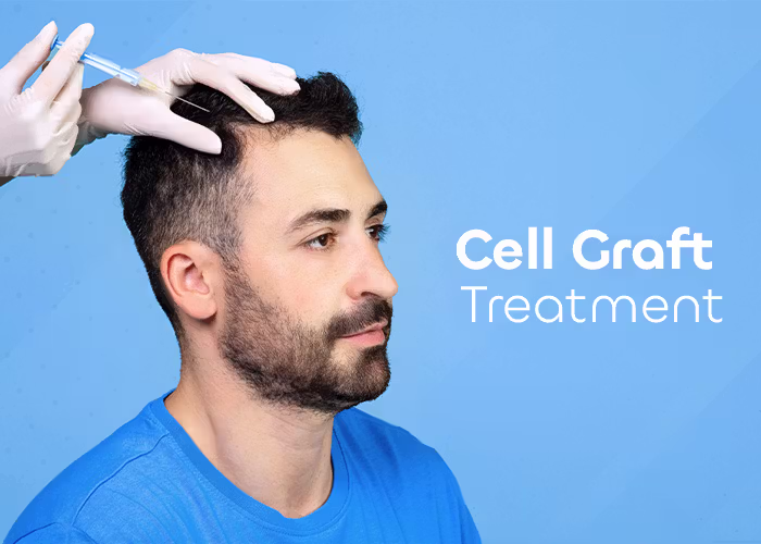 Baldness Doesn’t Have To Be Permanent Anymore
