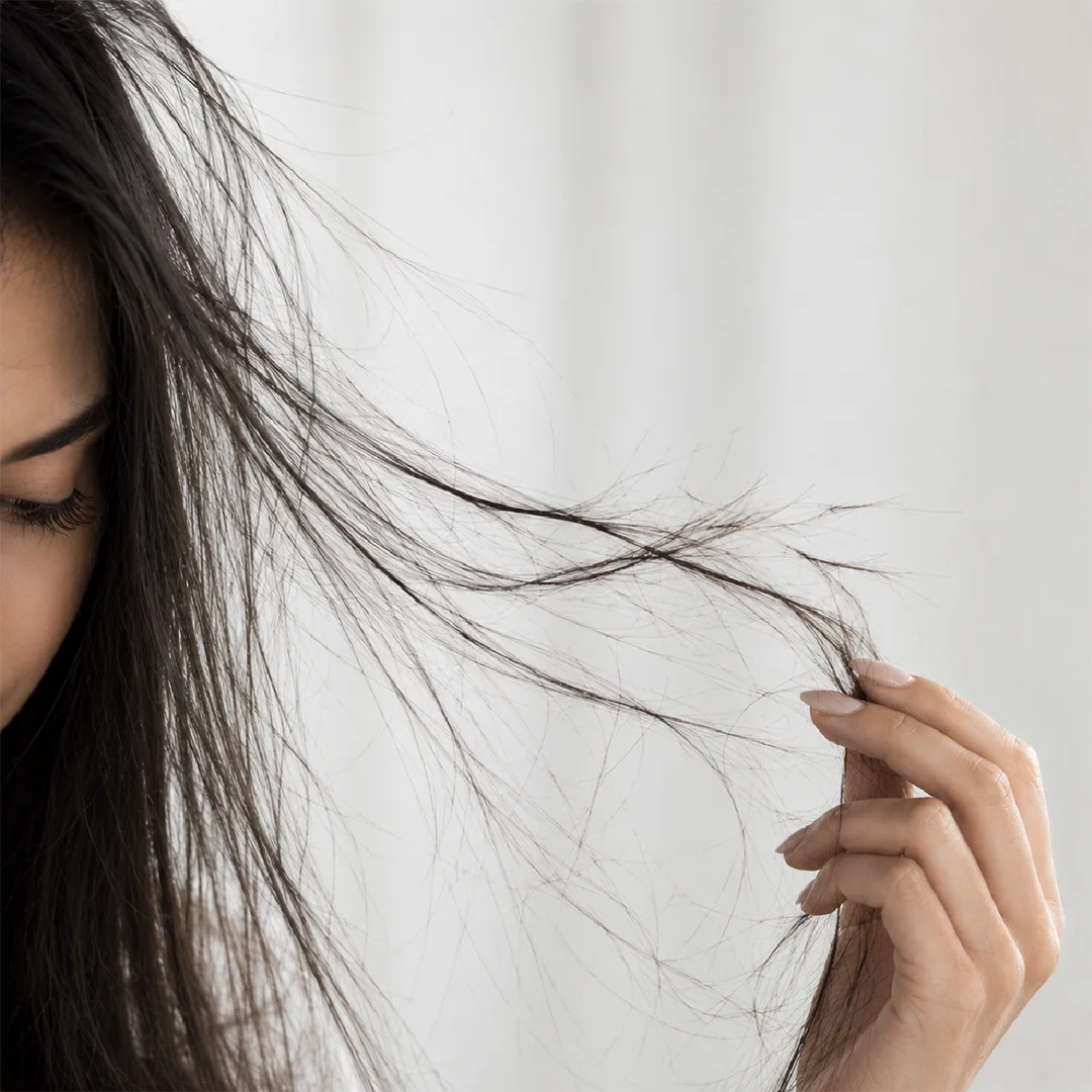 premature-grey-hair-treatment-vcare