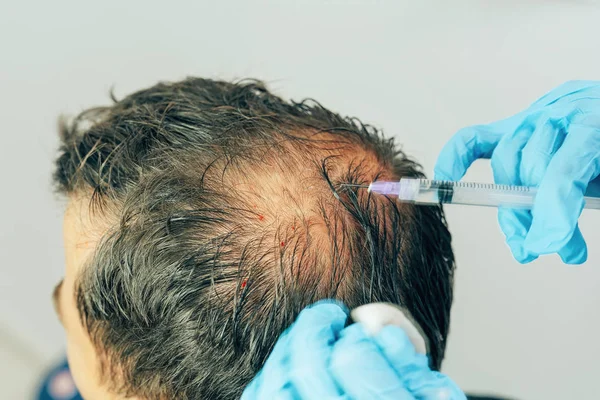 Gfc Hair Treatment