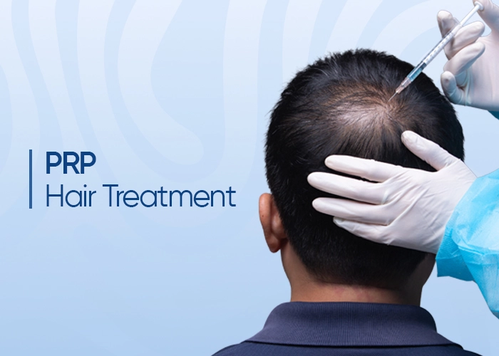 prp treatment for hair loss treatment 