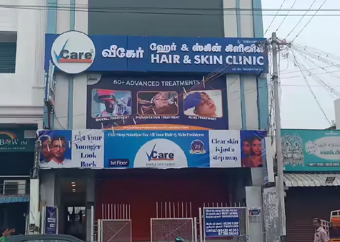 VCare Tirupur TamilNadu