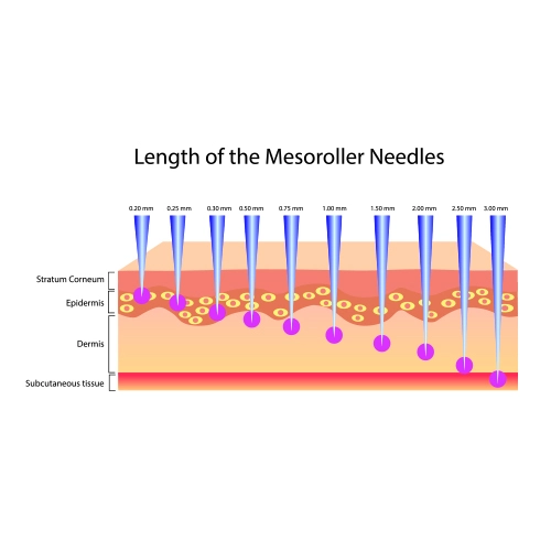 NEEDLE MESOTHERAPY