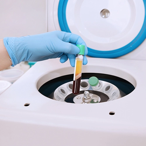 platelet-rich-plasma