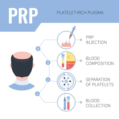 platelet-rich-plasma