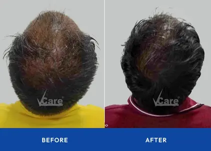 Before and after
