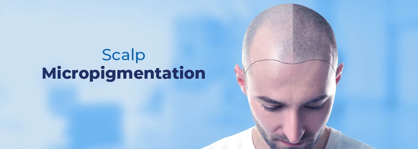 scalp_micro_pigmentation_vcare