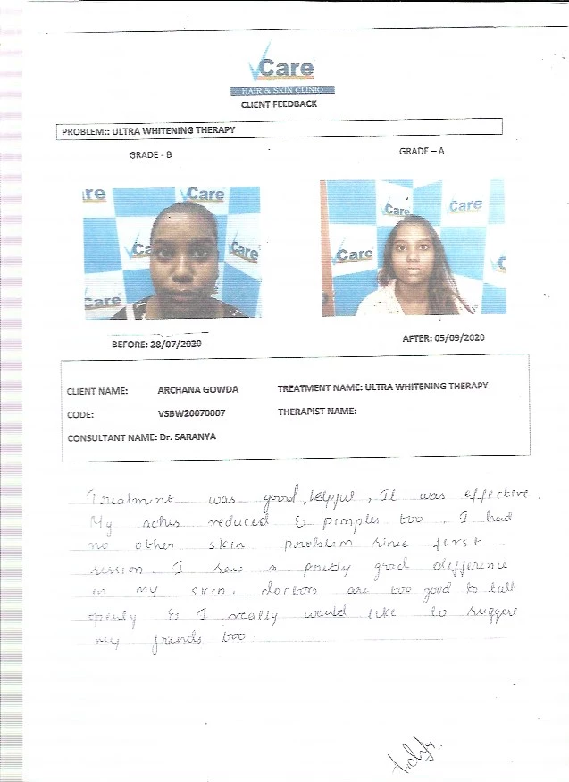 ultra_whitening_therapy_testimonal_vcare ultra_whitening_therapy_testimonal_vcare
