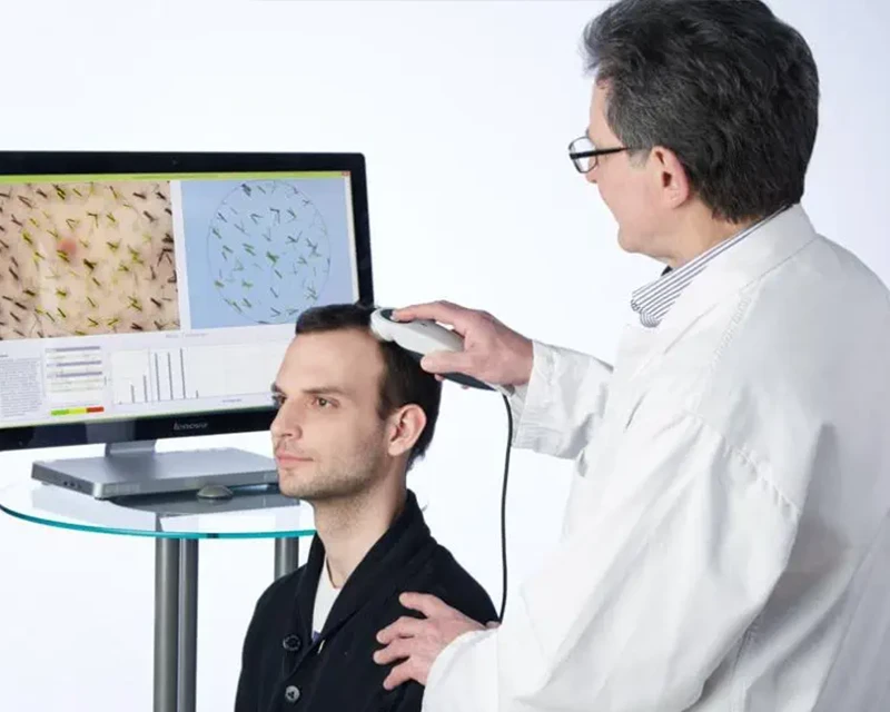 trichoscopic-analysis_vcare