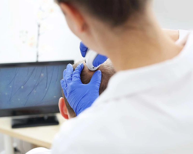 Trichoscan Hair Analysis Hair Growth Analysis VCare