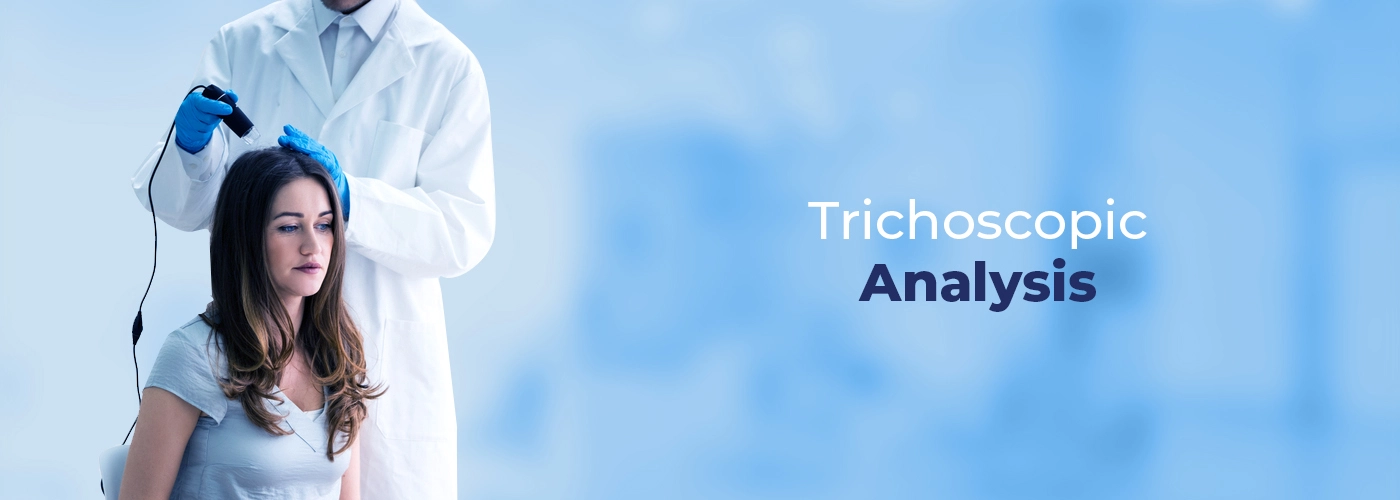 trichoscopy_treatment_in_vcare