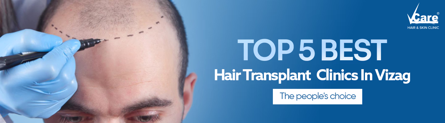 Top 5 Best Hair Transplant Clinics in visakhapatnam