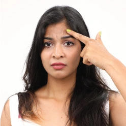 acne treatment