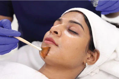 acne treatment