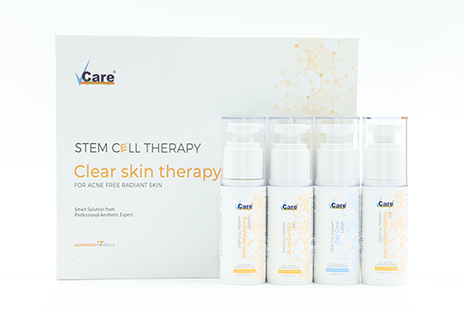 acne treatment