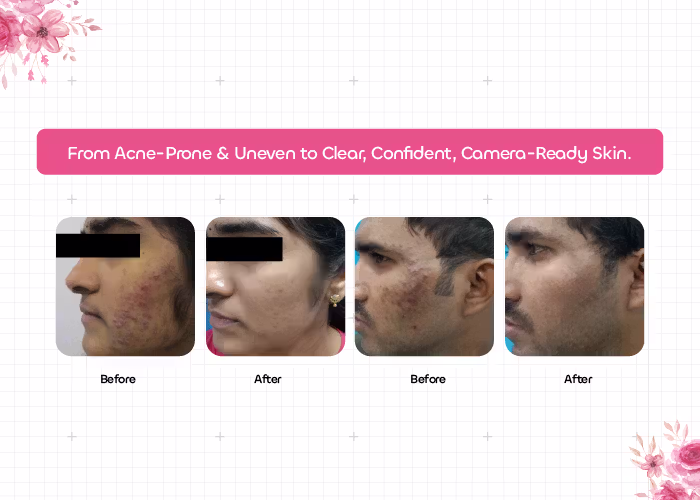 hair and skin treatment