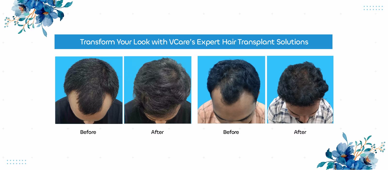 vcare    transplantation treatment