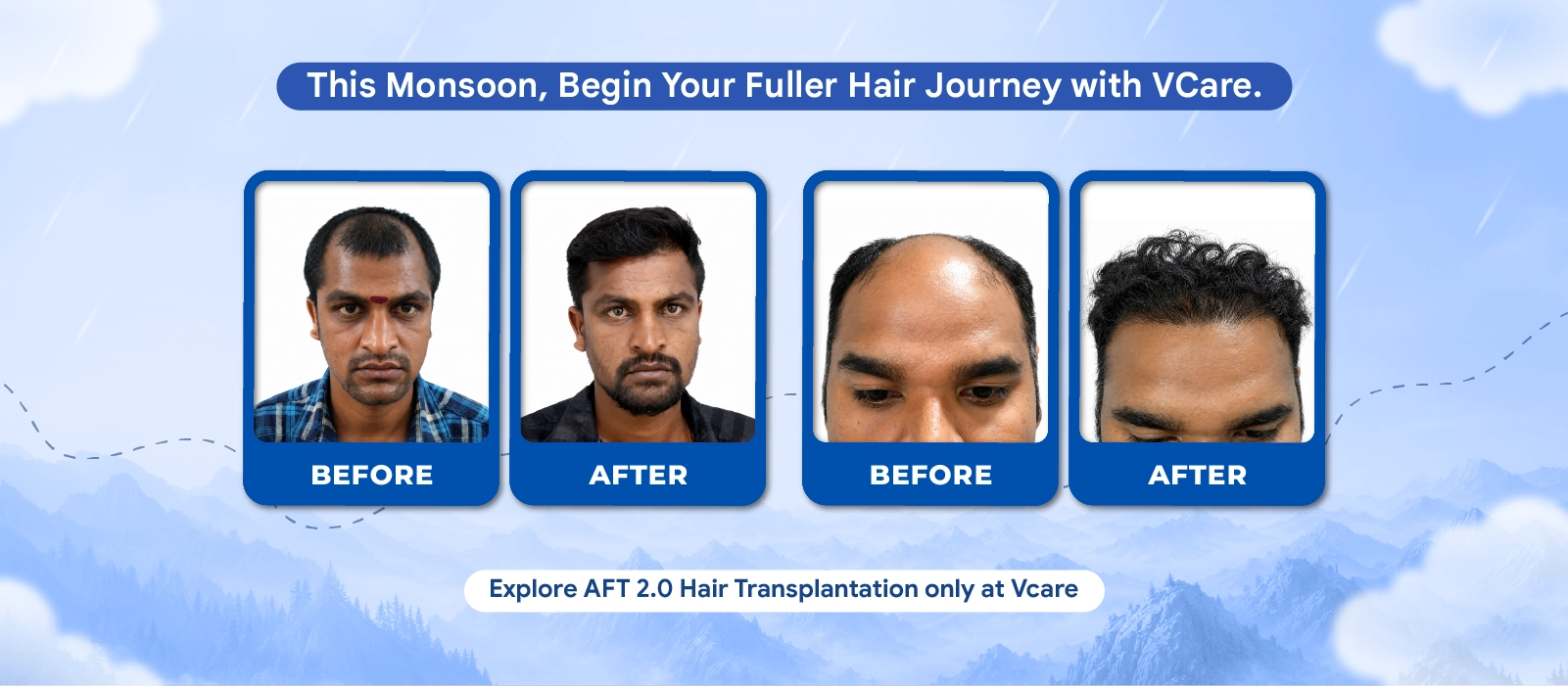 vcare    transplantation treatment