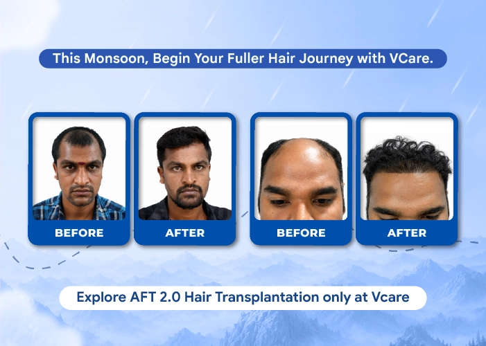 vcare transplantation treatment