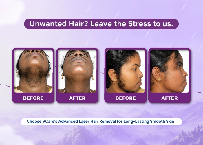 laser hair treatment
                    