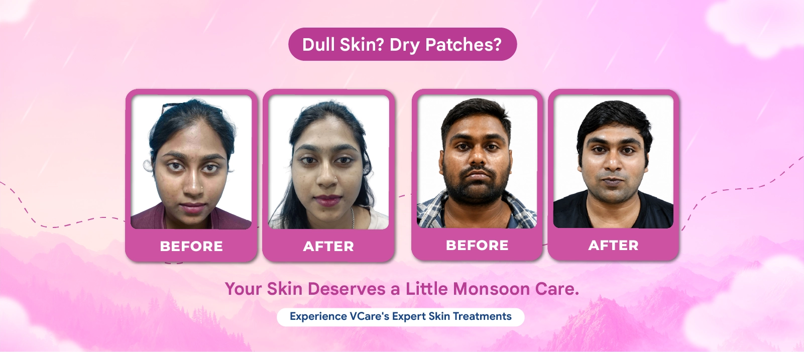 skin whitening treatment