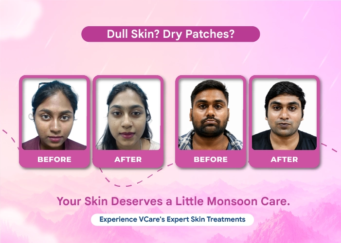 skin whitening treatment