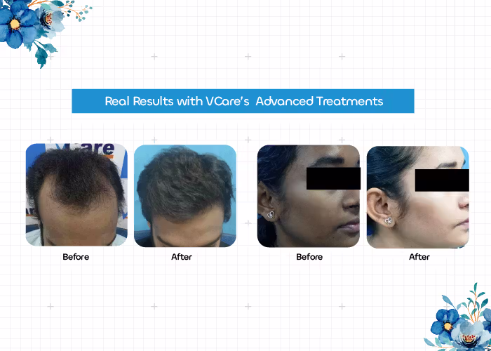 hair and skin treatment