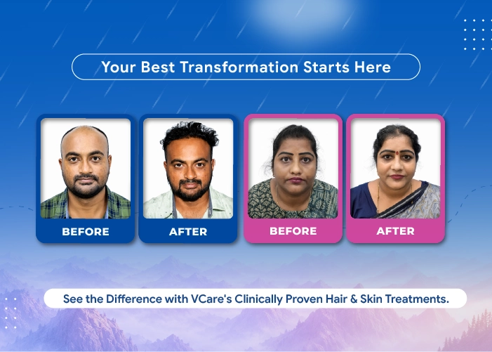 hair and skin treatment