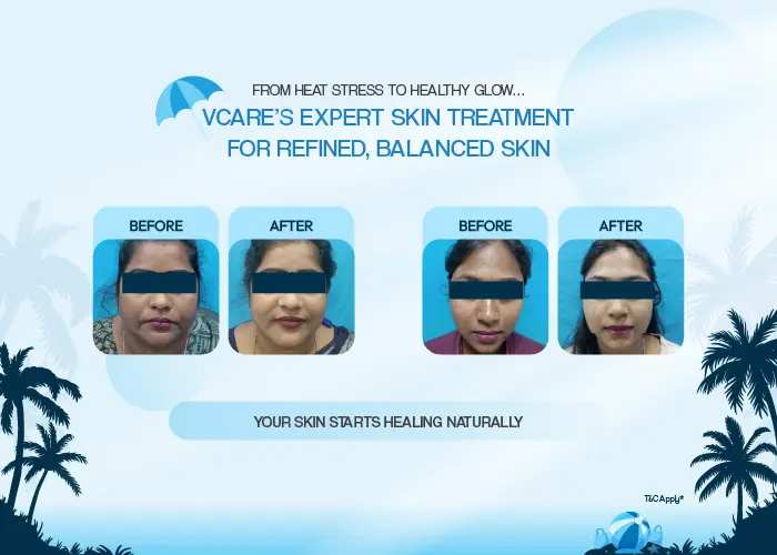 hair and skin treatment