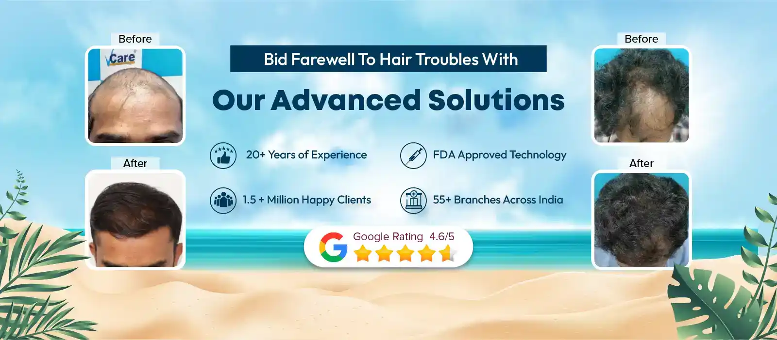Hair regrowth transplantaion
