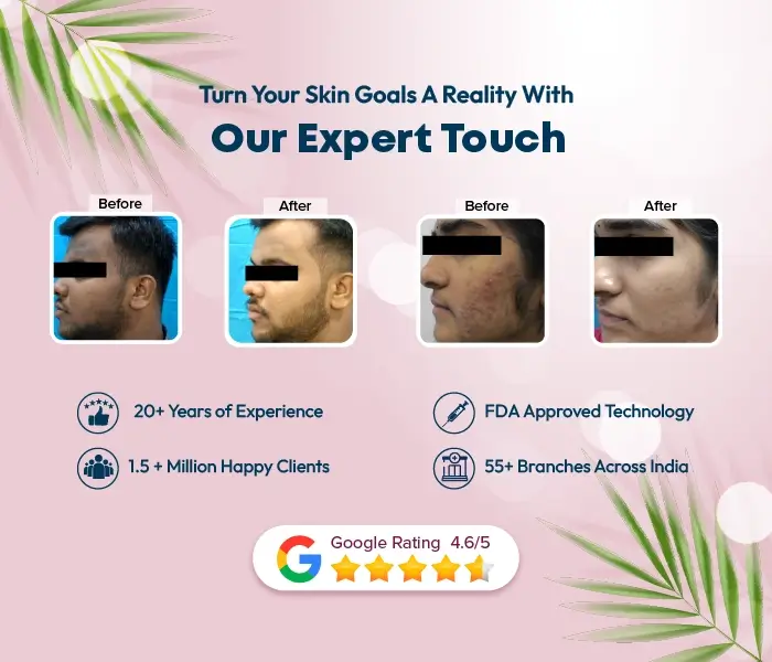 Skin Whitening The best skin care clinic in India VCare