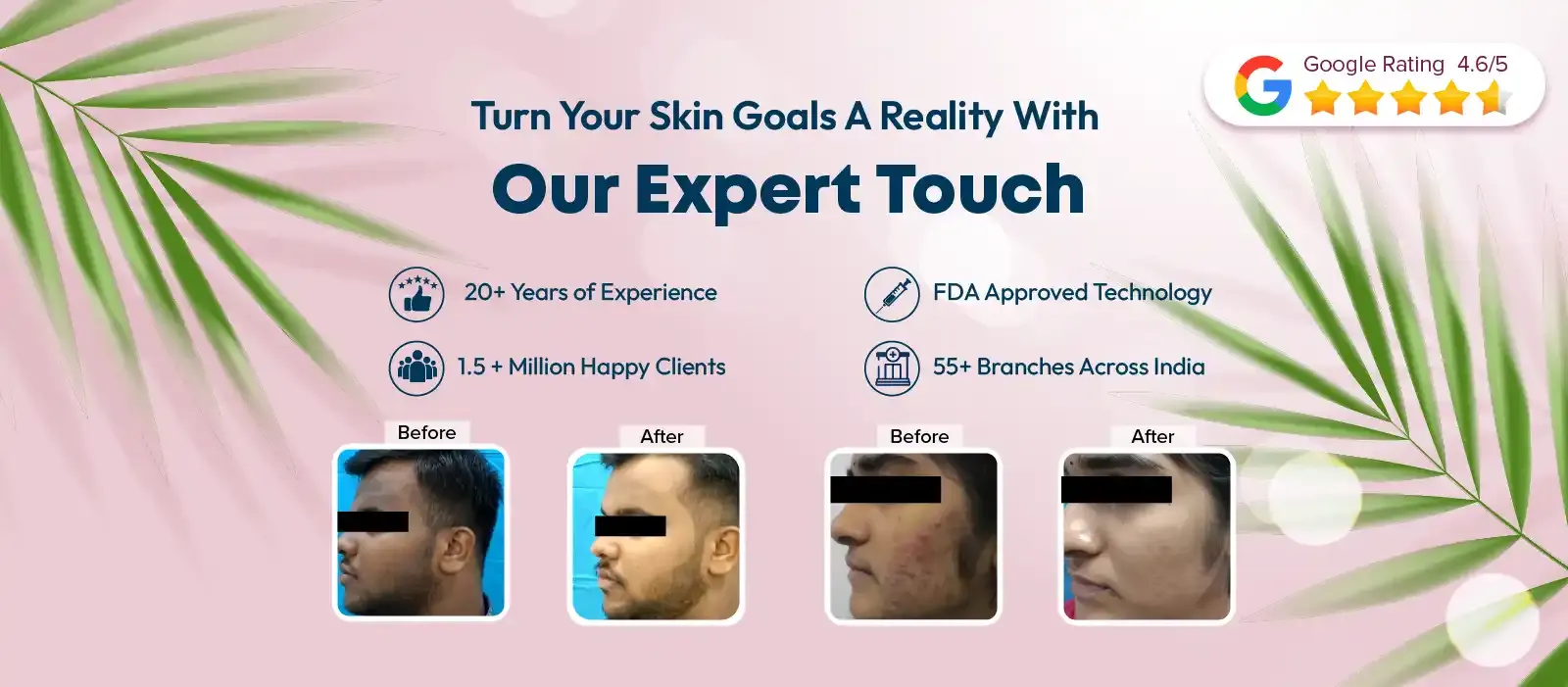 Skin Whitening The best skin care clinic in India VCare