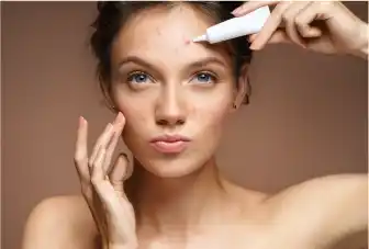 Acne-Treatment