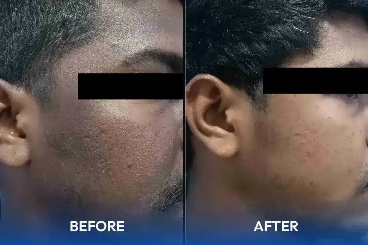 Hair and skin treatment