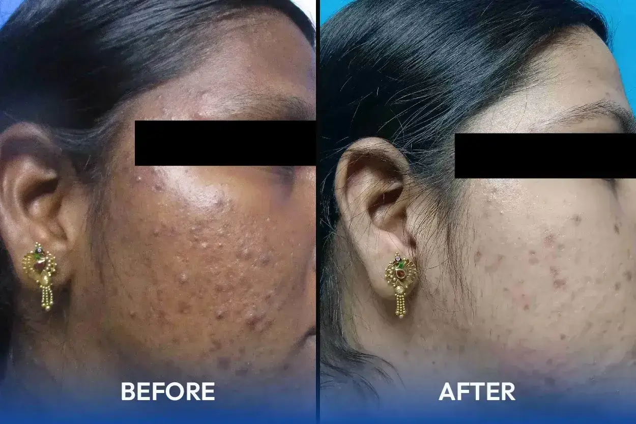 Hair and skin treatment
