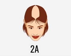 Hair transplant treatment
