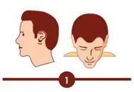 Hair transplant treatment