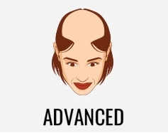 hair transplant treatment